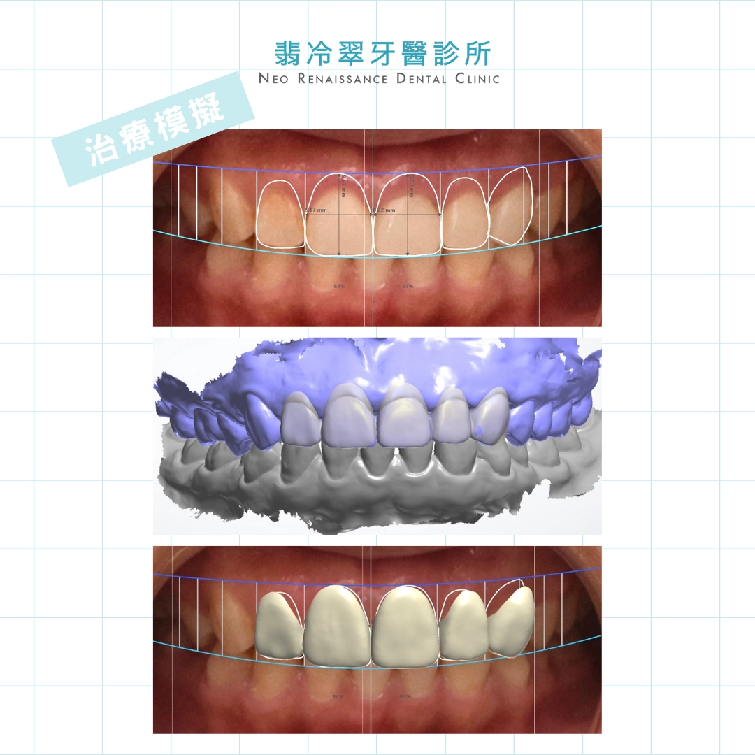 DSD數位微笑設計