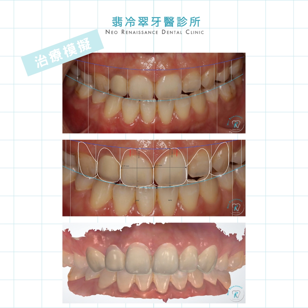 DSD數位微笑設計