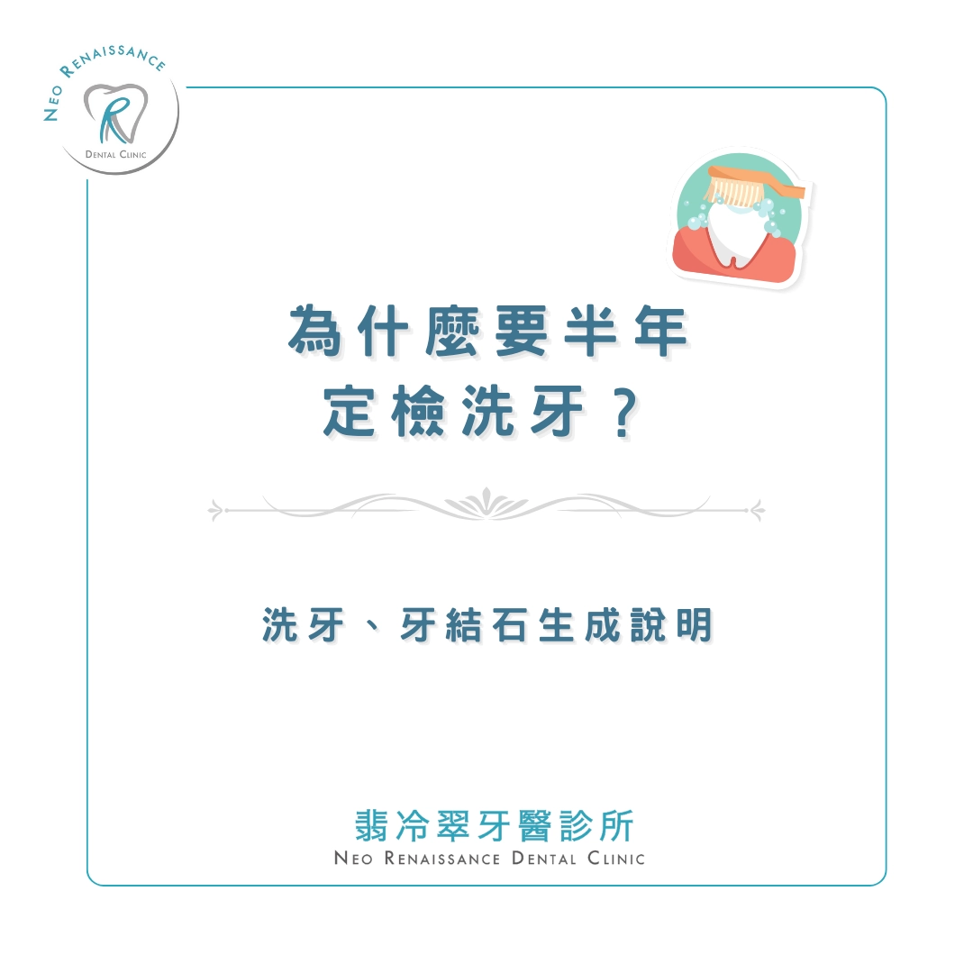 《為什麼要半年定檢洗牙呢？》