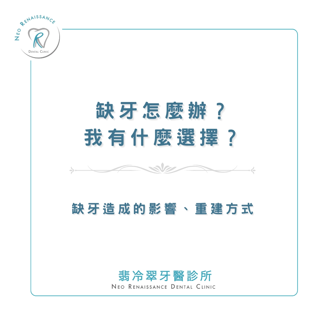 《缺牙怎麼辦？我有什麼選擇？》