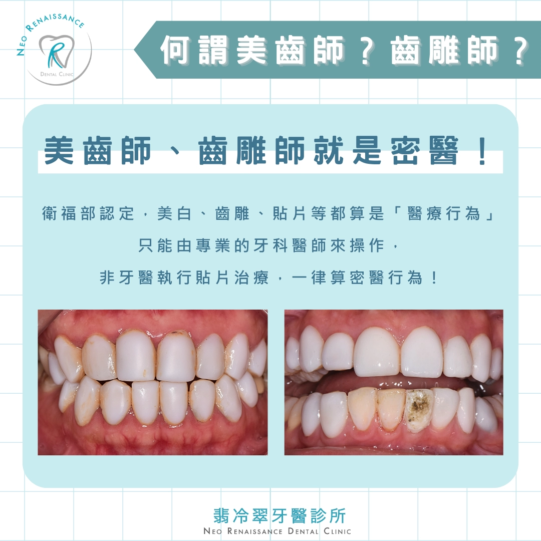 《牙齒要美白，醫師要有牌》