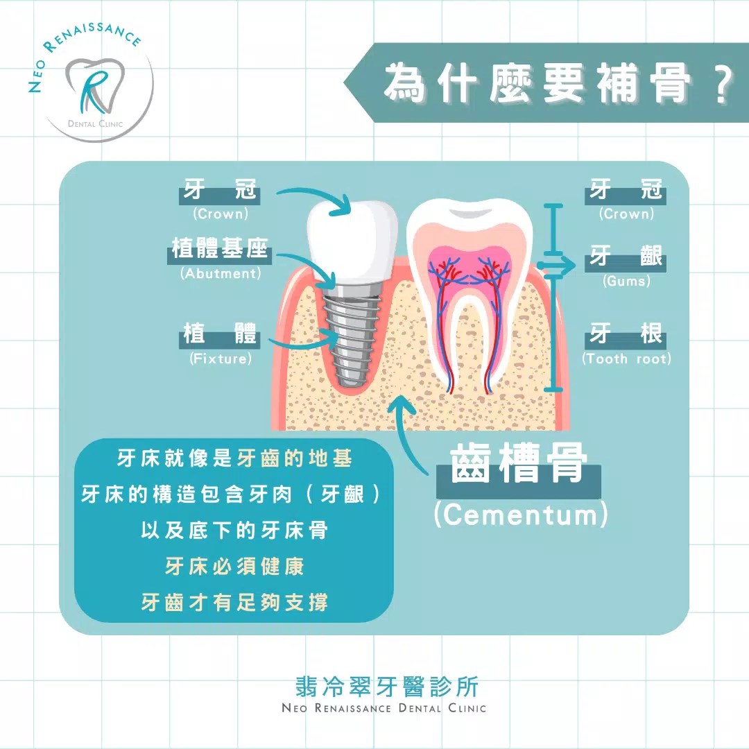 《補骨是什麼？》