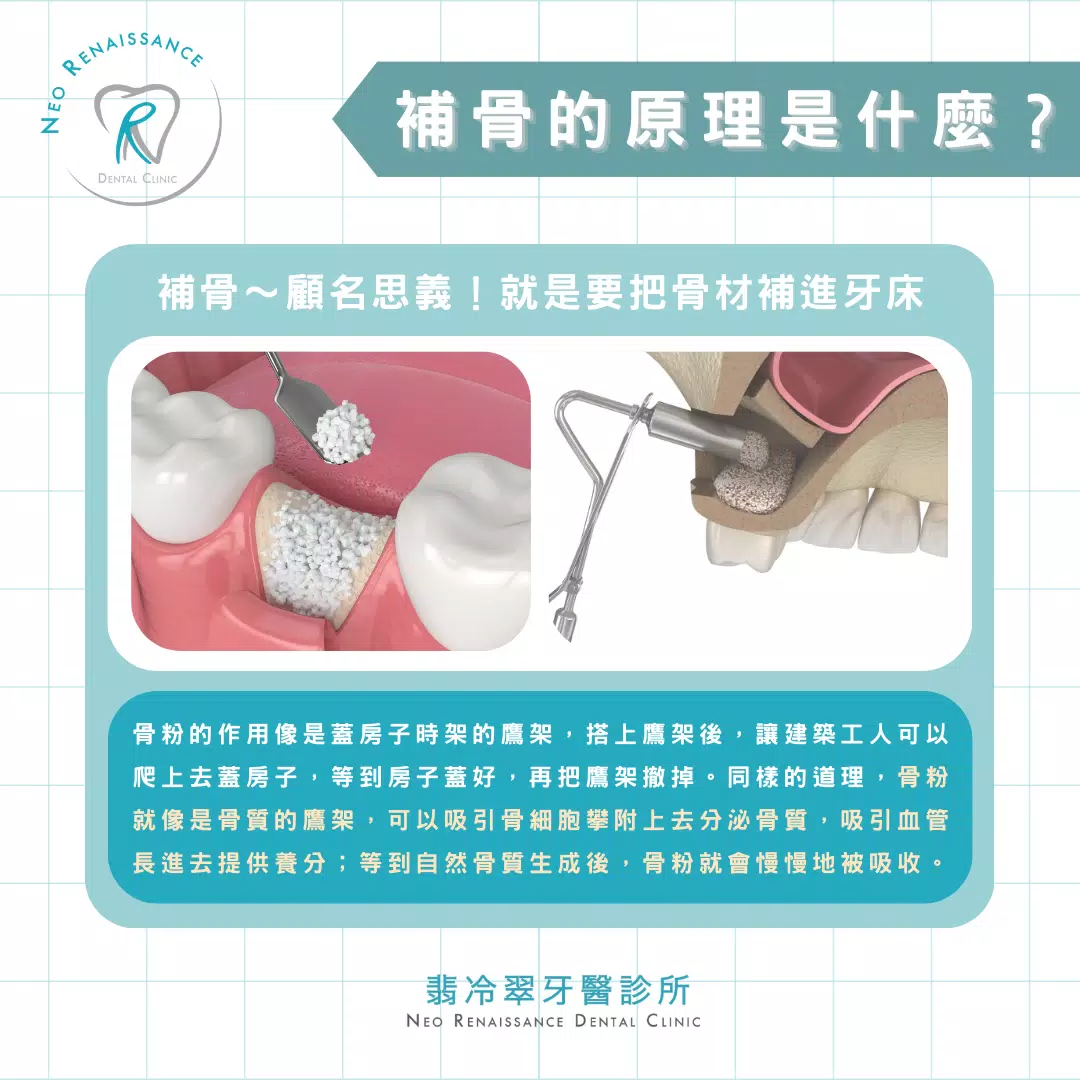 《補骨是什麼？》