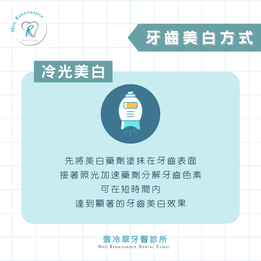 《牙齒美白會傷害牙齒嗎？》