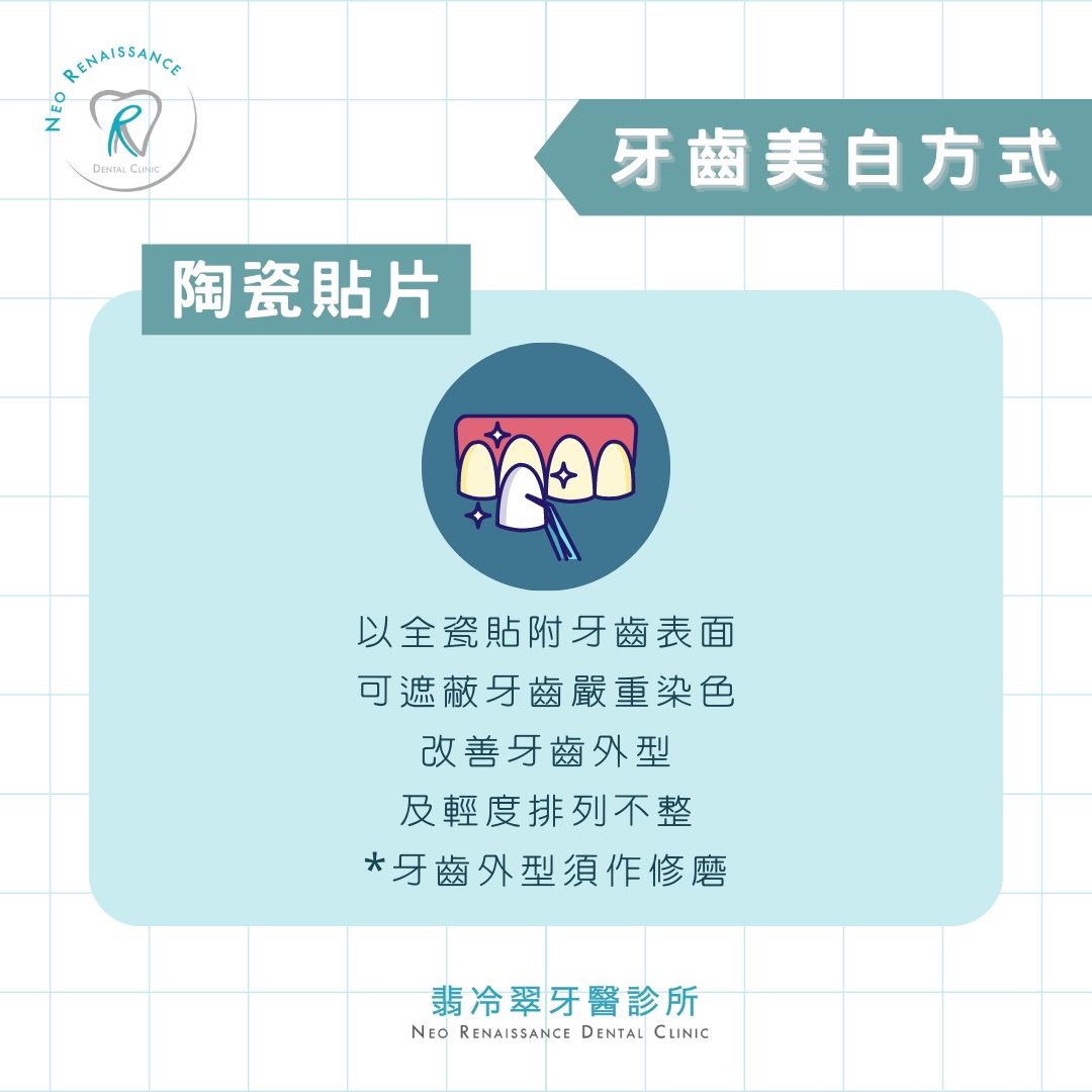 《牙齒美白會傷害牙齒嗎？》