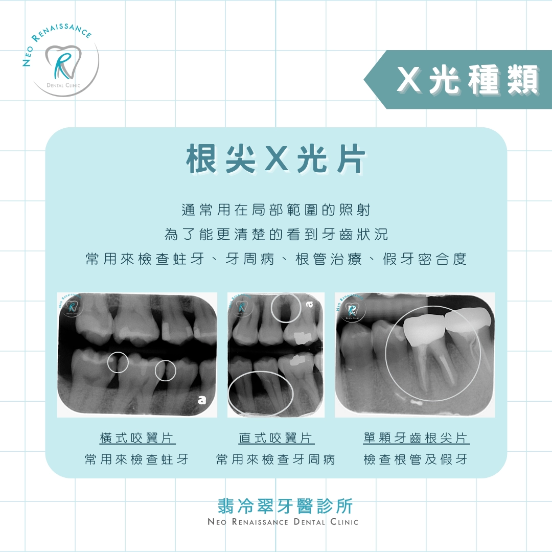《牙科X光大揭密》 《牙科X光大揭密》