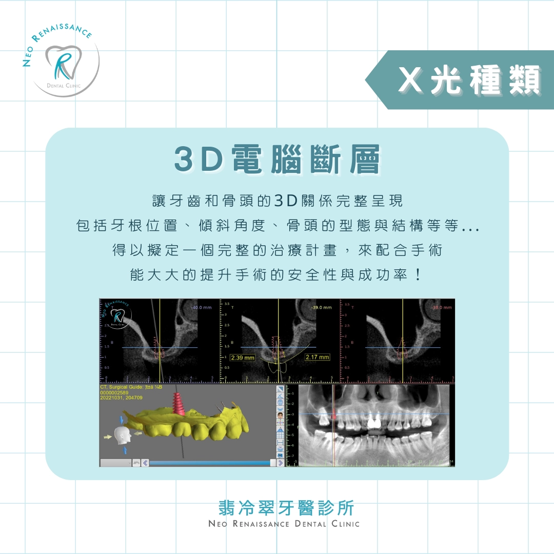 《牙科X光大揭密》 《牙科X光大揭密》