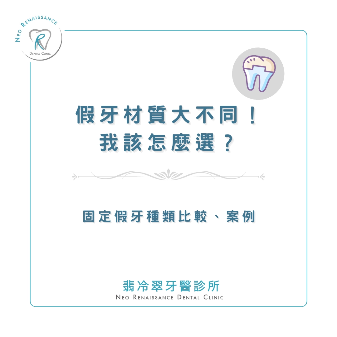 《假牙材質大不同！我該怎麼選？》