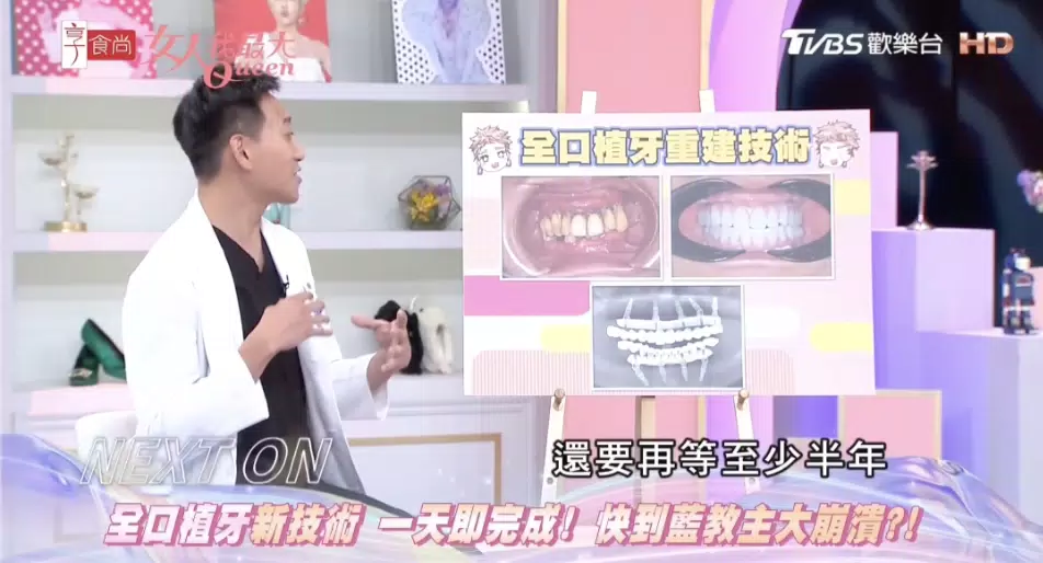 【女人我最大】最新技術 All-on-4一日全口重建，『1天』重獲好牙與尊嚴