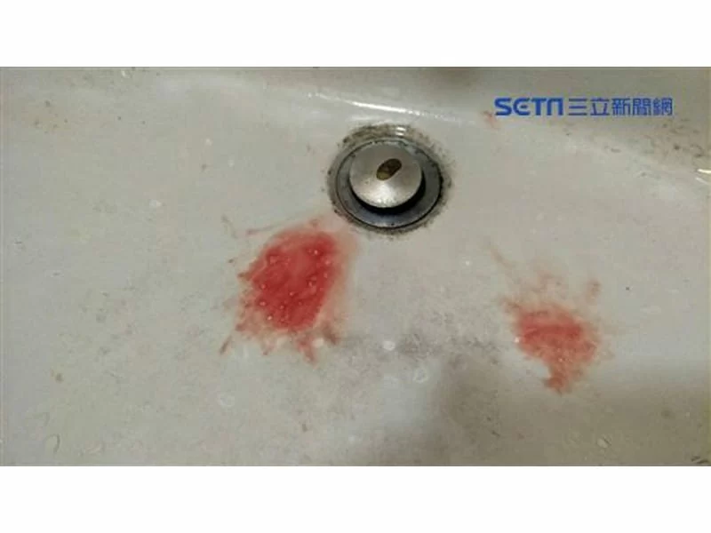 【三立採訪】口水帶血是牙周病警訊！　