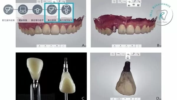 3shape數位口內掃描器