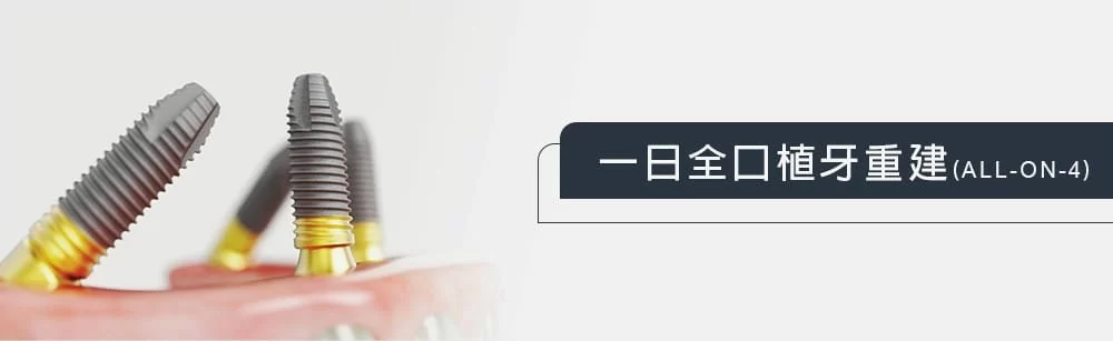 一日全口重建 一日全口重建