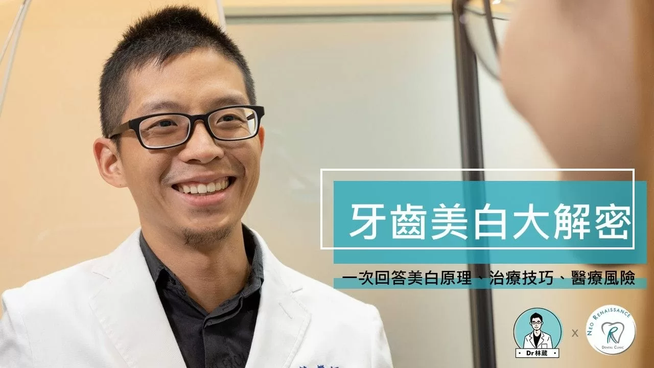 牙齒美白大解密 牙齒美白大解密
