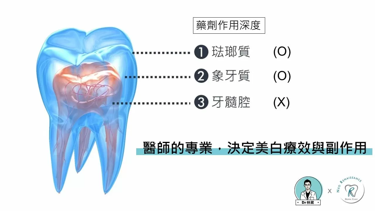 牙齒美白大解密 牙齒美白大解密